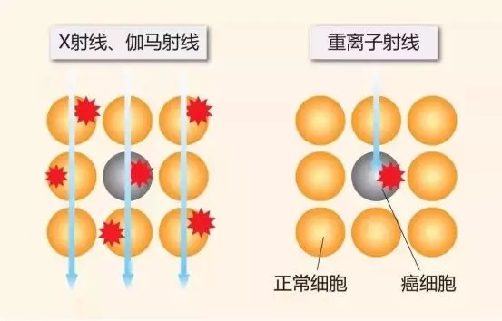 質(zhì)子重離子技術(shù)醫(yī)療險(xiǎn)可以報(bào)銷嗎？